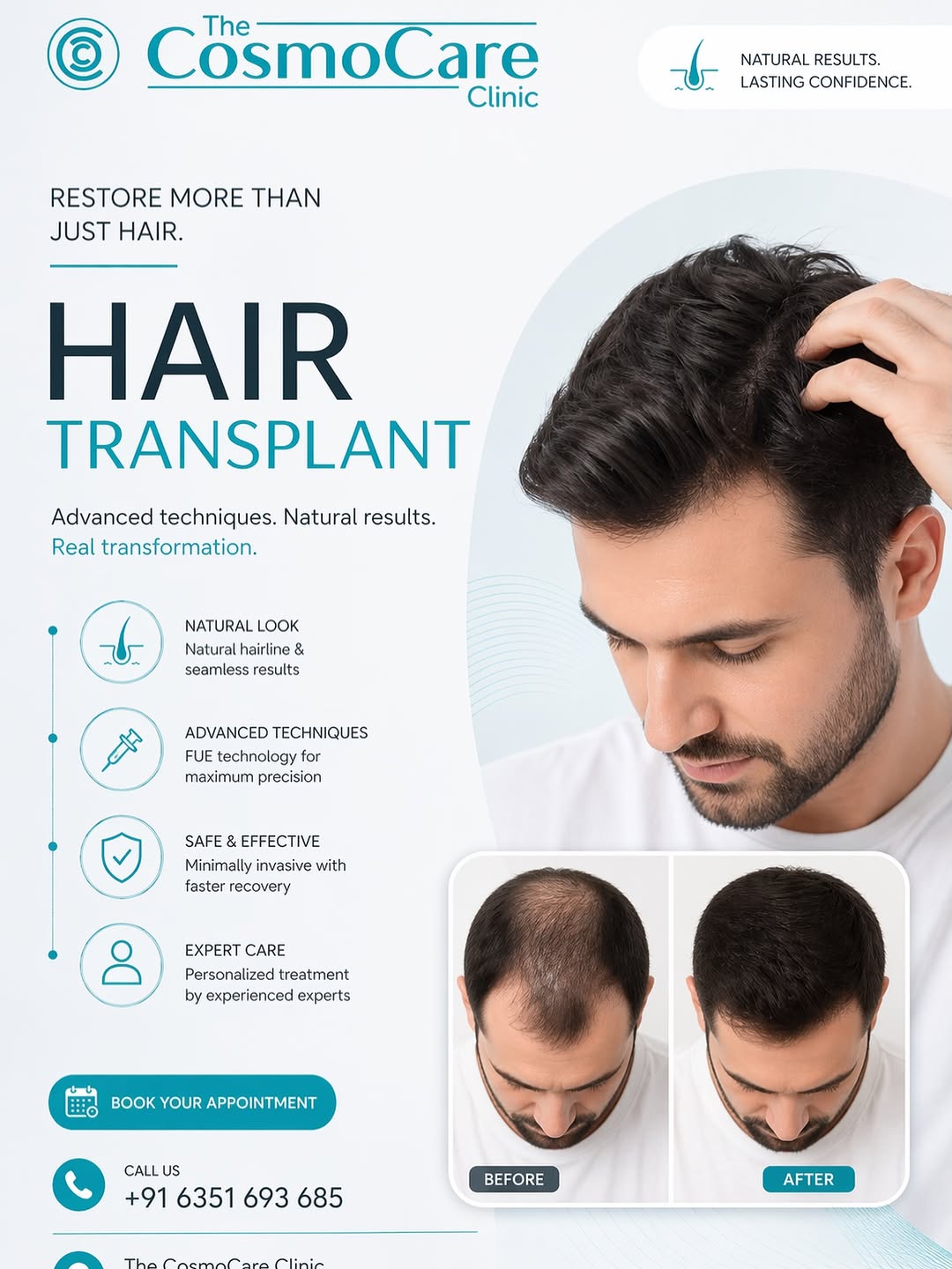 FUE natural hairline hair transplant — CosmoCare Vapi